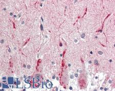 GABRG2 Antibody - Anti-GABRG2 antibody IHC staining of human brain, cerebellum. Immunohistochemistry of formalin-fixed, paraffin-embedded tissue after heat-induced antigen retrieval. Antibody concentration 15 ug/ml. This image was taken for the unconjugated form of this product. Other forms have not been tested.