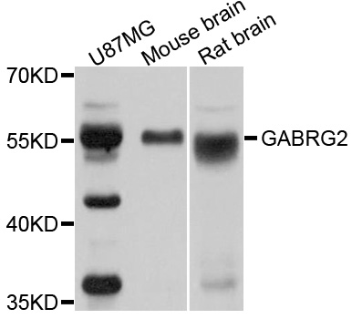 GABRG2 Antibody - Western blot analysis of extracts of various cell lines, using GABRG2 antibody at 1:1000 dilution. The secondary antibody used was an HRP Goat Anti-Rabbit IgG (H+L) at 1:10000 dilution. Lysates were loaded 25ug per lane and 3% nonfat dry milk in TBST was used for blocking. An ECL Kit was used for detection and the exposure time was 20s.