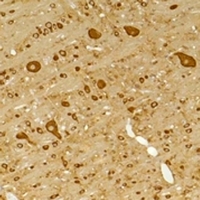 GABRG2 Antibody - Immunohistochemical analysis of GABRG2 staining in rat brain;mouse brain formalin fixed paraffin embedded tissue section. The section was pre-treated using heat mediated antigen retrieval with sodium citrate buffer (pH 6.0). The section was then incubated with the antibody at room temperature and detected using an HRP conjugated compact polymer system. DAB was used as the chromogen. The section was then counterstained with hematoxylin and mounted with DPX.