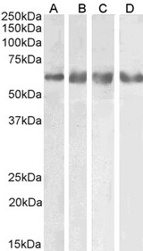GABRG2 Antibody - Goat Anti-GABRG2 (aa384-396) Antibody (0.1µg/ml) staining of Human Cerebellum (A), Mouse (B), Rat (C) and Pig (D) Brain lysate (35µg protein in RIPA buffer). Primary incubation was 1 hour. Detected by chemiluminescencence.