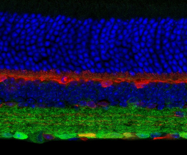 GABRG2 Antibody - Immunostaining of mouse retina showing specific labeling of the GABAA ?2 subunit in green, calbindin in red and DNA in blue. Photo courtesy of Dr. Arlene Hirano, UCLA.
