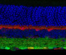 GABRG2 Antibody - Immunostaining of mouse retina showing specific labeling of the GABAA ?2 subunit in green, calbindin in red and DNA in blue. Photo courtesy of Dr. Arlene Hirano, UCLA.