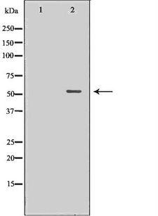 GABRG2 Antibody - Western blot analysis of extracts of brain tissue using GABRG2 antibody. The lane on the left is treated with the antigen-specific peptide.