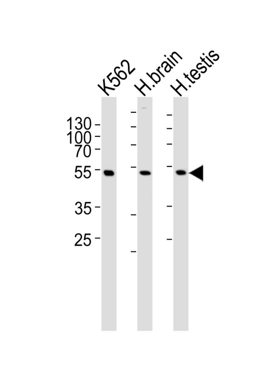 GABRG3 Antibody - Western blot of lysates from K562 cell line and human brain, testis tissue lysate(from left to right), using GABRG3 Antibody. Antibody was diluted at 1:1000 at each lane. A goat anti-rabbit IgG H&L (HRP) at 1:5000 dilution was used as the secondary antibody. Lysates at 35ug per lane.