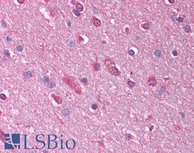 GABRQ / THETA Antibody - Anti-GABRQ antibody IHC of human brain, cortex. Immunohistochemistry of formalin-fixed, paraffin-embedded tissue after heat-induced antigen retrieval. Antibody concentration 5 ug/ml.  This image was taken for the unconjugated form of this product. Other forms have not been tested.