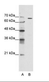 GABRQ / THETA Antibody - A: Marker, B: Jurkat Cell Lysate.  This image was taken for the unconjugated form of this product. Other forms have not been tested.