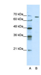 GABRQ / THETA Antibody - GABRQ antibody Western blot of Jurkat lysate. This image was taken for the unconjugated form of this product. Other forms have not been tested.