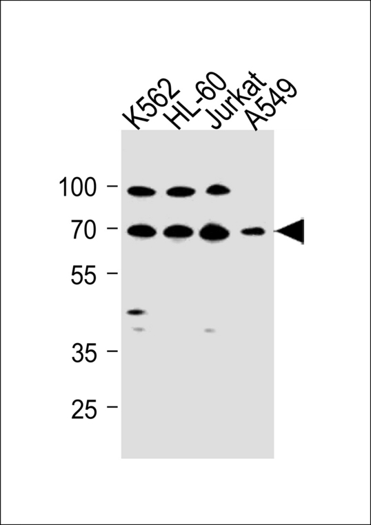 GABRQ / THETA Antibody - GABRQ Antibody western blot of K562,HL-60,Jurkat,A549 cell line lysates (35 ug/lane). The GABRQ antibody detected the GABRQ protein (arrow).