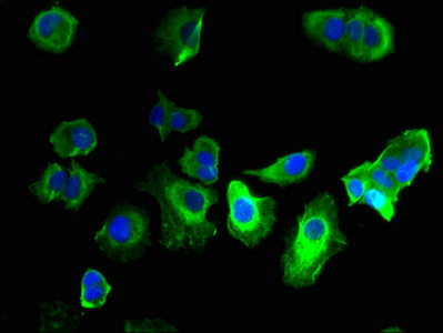 GABRQ / THETA Antibody - Immunofluorescent analysis of MCF-7 cells using GABRQ Antibody at dilution of 1:100 and Alexa Fluor 488-congugated AffiniPure Goat Anti-Rabbit IgG(H+L)