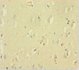 GABRQ / THETA Antibody - Immunohistochemistry of paraffin-embedded human brain tissue using GABRQ Antibody at dilution of 1:100