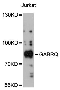 GABRQ / THETA Antibody - Western blot analysis of extracts of Jurkat cells, using GABRQ antibody at 1:3000 dilution. The secondary antibody used was an HRP Goat Anti-Rabbit IgG (H+L) at 1:10000 dilution. Lysates were loaded 25ug per lane and 3% nonfat dry milk in TBST was used for blocking. An ECL Kit was used for detection and the exposure time was 90s.
