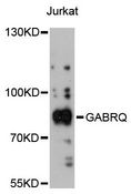 GABRQ / THETA Antibody - Western blot analysis of extracts of Jurkat cells, using GABRQ antibody at 1:3000 dilution. The secondary antibody used was an HRP Goat Anti-Rabbit IgG (H+L) at 1:10000 dilution. Lysates were loaded 25ug per lane and 3% nonfat dry milk in TBST was used for blocking. An ECL Kit was used for detection and the exposure time was 90s.