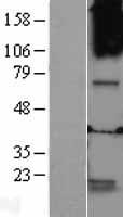 GABRQ / THETA Protein - Western validation with an anti-DDK antibody * L: Control HEK293 lysate R: Over-expression lysate