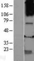 GABRQ / THETA Protein - Western validation with an anti-DDK antibody * L: Control HEK293 lysate R: Over-expression lysate