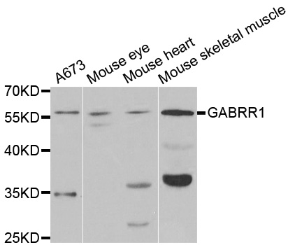 GABRR1 / GABA(A) Receptor rho- Antibody - Western blot analysis of extracts of various cell lines.