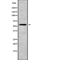 GABRR1 / GABA(A) Receptor rho- Antibody - Western blot analysis GABRR1 using COLO205 whole cells lysates