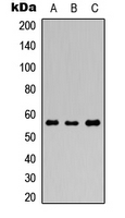 GABRR1 / GABA(A) Receptor rho- Antibody - Western blot analysis of GABRR1 expression in HEK293T (A); Raw264.7 (B); PC12 (C) whole cell lysates.