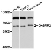GABRR2 Antibody - Western blot analysis of extracts of various cell lines, using GABRR2 antibody at 1:1000 dilution. The secondary antibody used was an HRP Goat Anti-Rabbit IgG (H+L) at 1:10000 dilution. Lysates were loaded 25ug per lane and 3% nonfat dry milk in TBST was used for blocking. An ECL Kit was used for detection and the exposure time was 30s.
