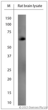GAD 65+67 Antibody - Rabbit antibody to GAD65, 67 (530-600). WB on rat brain lysate using Rabbit antibody to GAD65, 67 (530-600)at 1:500 dilution. Incubated 30 min at RT with shake. Blocking: 0.5% LFDM in 1x PBS containing 0.1% Tween-20