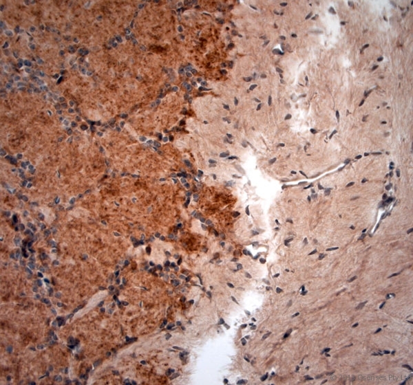 GAD 65+67 Antibody - Rabbit antibody to GAD65, 67 (530-600). IHC-P on paraffin sections of mouse olfactory bulb. The animal was perfused using Autoperfuser at a pressure of 110 mm Hg with 300 ml 4% FA and further post fixed overnight before being processed for paraffin embedding. HIER: Tris-EDTA, pH 9 for 20 min using Thermo PT Module. Blocking: 0.2% LFDM in TBST filtered through a 0.2 micron filter. Detection was done using Novolink HRP polymer from Leica following manufacturers instructions, using DAB chromogen. Primary antibody: dilution 1:1000, incubated 30 min at RT using Autostainer. Sections were counterstained with Harris Hematoxylin.