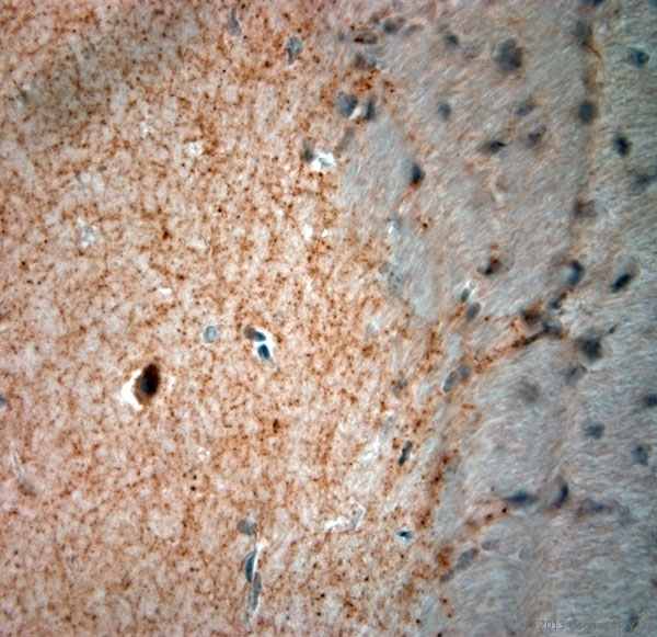 GAD 65+67 Antibody - Rabbit antibody to GAD65, 67 (530-600). IHC-P on paraffin sections of mouse cerebellum. The animal was perfused using Autoperfuser at a pressure of 110 mm Hg with 300 ml 4% FA and further post fixed overnight before being processed for paraffin embedding. HIER: Tris-EDTA, pH 9 for 20 min using Thermo PT Module. Blocking: 0.2% LFDM in TBST filtered through a 0.2 micron filter. Detection was done using Novolink HRP polymer from Leica following manufacturers instructions, using DAB chromogen. Primary antibody: dilution 1:1000, incubated 30 min at RT using Autostainer. Sections were counterstained with Harris Hematoxylin.