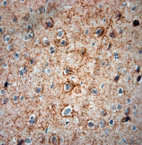GAD 65+67 Antibody - Rabbit antibody to GAD65, 67 (530-600). IHC-P on paraffin sections of mouse cerebellum. The animal was perfused using Autoperfuser at a pressure of 110 mm Hg with 300 ml 4% FA and further post fixed overnight before being processed for paraffin embedding. HIER: Tris-EDTA, pH 9 for 20 min using Thermo PT Module. Blocking: 0.2% LFDM in TBST filtered through a 0.2 micron filter. Detection was done using Novolink HRP polymer from Leica following manufacturers instructions, using DAB chromogen. Primary antibody: dilution 1:1000, incubated 30 min at RT using Autostainer. Sections were counterstained with Harris Hematoxylin.