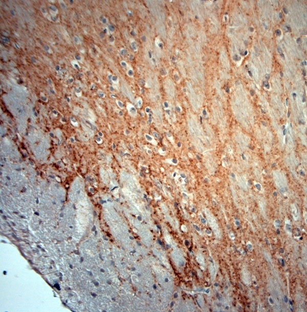 GAD 65+67 Antibody - Rabbit antibody to GAD65, 67 (530-600). IHC-P on paraffin sections of rat brain. The animal was perfused using Autoperfuser at a pressure of 110 mm Hg with 300 ml 4% FA and further post fixed overnight before being processed for paraffin embedding. HIER: Tris-EDTA, pH 9 for 20 min using Thermo PT Module. Blocking: 0.2% LFDM in TBST filtered through a 0.2 micron filter. Detection was done using Novolink HRP polymer from Leica following manufacturers instructions, using DAB chromogen. Primary antibody: dilution 1:1000, incubated 30 min at RT using Autostainer. Sections were counterstained with Harris Hematoxylin.