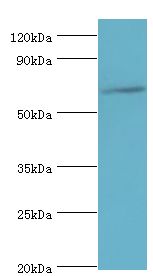 GAD1 / GAD67 Antibody - Western blot. All lanes: Glutamate decarboxylase 1 antibody at 10 ug/ml+rat brain tissue. Secondary antibody: Goat polyclonal to rabbit at 1:10000 dilution. Predicted band size: 67 kDa. Observed band size: 67 kDa Immunohistochemistry.