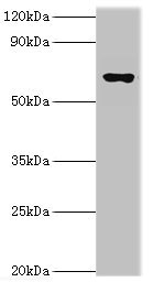 GAD1 / GAD67 Antibody - Western blot All lanes: Glutamate decarboxylase 1 antibody at 10µg/ml + Rat brain tissue Secondary Goat polyclonal to rabbit IgG at 1/10000 dilution Predicted band size: 67, 26, 48 kDa Observed band size: 67 kDa