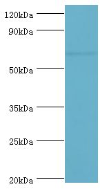 GAD1 / GAD67 Antibody - Western blot. All lanes: Glutamate decarboxylase 1 antibody at 8 ug/ml+HepG2 whole cell lysate. Secondary antibody: Goat polyclonal to rabbit at 1:10000 dilution. Predicted band size: 67 kDa. Observed band size: 67 kDa Immunohistochemistry.