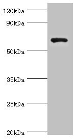 GAD1 / GAD67 Antibody - Western blot All lanes: Glutamate decarboxylase 1 antibody at 8µg/ml + HepG2 whole cell lysate Secondary Goat polyclonal to rabbit IgG at 1/10000 dilution Predicted band size: 67, 26, 48 kDa Observed band size: 67 kDa
