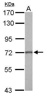 GAD1 / GAD67 Antibody - GAD67 antibody detects GAD1 protein by Western blot analysis. A. 50 ug rat brain lysate/extract. 7.5 % SDS-PAGE. GAD67 antibody dilution:1:500