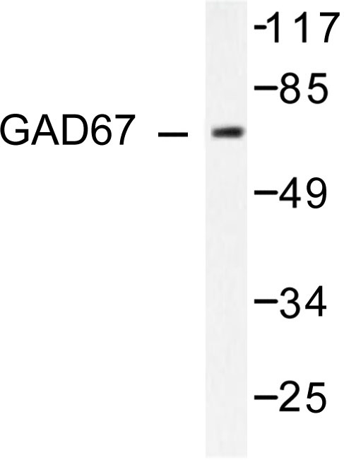 GAD1 / GAD67 Antibody - Western blot of GAD67 (A492) pAb in extracts from LOVO cells.
