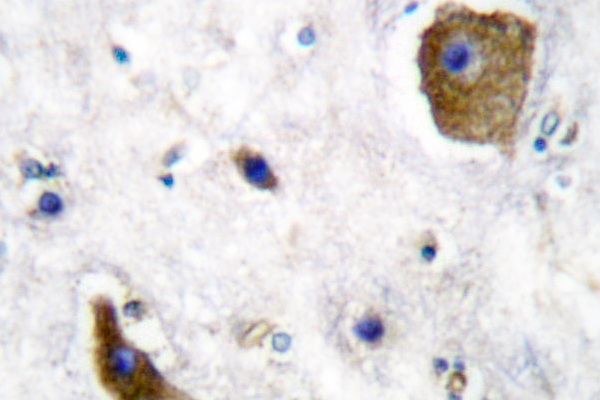 GAD1 / GAD67 Antibody - IHC of GAD67 (A492) pAb in paraffin-embedded human brain tissue.