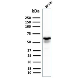 GAD1 / GAD67 Antibody - Western blot testing of human brain lysate with GAD67 antibody. Expected molecular weight ~67 kDa.