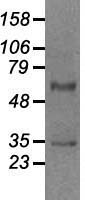 GAD1 / GAD67 Antibody - Western blot analysis of 35ug of cell extracts from human (HeLa) cells using anti-GAD1 antibody.