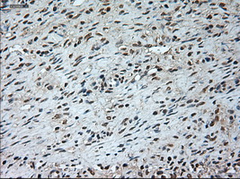 GAD1 / GAD67 Antibody - Immunohistochemical staining of paraffin-embedded Ovary tissue using anti-GAD1 mouse monoclonal antibody. (Dilution 1:50).