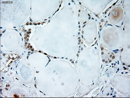 GAD1 / GAD67 Antibody - Immunohistochemical staining of paraffin-embedded thyroid tissue using anti-GAD1 mouse monoclonal antibody. (Dilution 1:50).