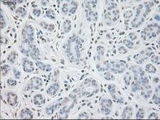 GAD1 / GAD67 Antibody - Immunohistochemical staining of paraffin-embedded breast tissue using anti-GAD1 mouse monoclonal antibody. (Dilution 1:50).