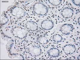 GAD1 / GAD67 Antibody - Immunohistochemical staining of paraffin-embedded colon tissue using anti-GAD1 mouse monoclonal antibody. (Dilution 1:50).