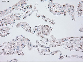 GAD1 / GAD67 Antibody - Immunohistochemical staining of paraffin-embedded lung tissue using anti-GAD1 mouse monoclonal antibody. (Dilution 1:50).