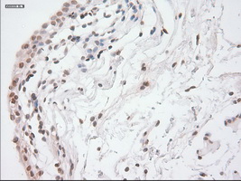 GAD1 / GAD67 Antibody - Immunohistochemical staining of paraffin-embedded bladder tissue using anti-GAD1 mouse monoclonal antibody. (Dilution 1:50).