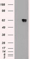 GAD1 / GAD67 Antibody - HEK293T cells were transfected with the pCMV6-ENTRY control (Left lane) or pCMV6-ENTRY GAD1 (Right lane) cDNA for 48 hrs and lysed. Equivalent amounts of cell lysates (5 ug per lane) were separated by SDS-PAGE and immunoblotted with anti-GAD1.