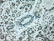 GAD1 / GAD67 Antibody - IHC of paraffin-embedded breast tissue using anti-GAD1 mouse monoclonal antibody. (Dilution 1:50).