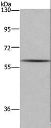 GAD1 / GAD67 Antibody - Western blot analysis of Human fetal brain tissue, using GAD1 Polyclonal Antibody at dilution of 1:571.
