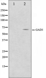 GAD1 / GAD67 Antibody - Western blot analysis on LOVO cells cell lysates using GAD1 antibody. The lane on the left is treated with the antigen-specific peptide.