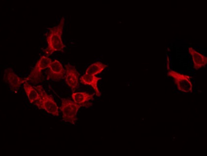 GAD1 / GAD67 Antibody - Staining LOVO cells by IF/ICC. The samples were fixed with PFA and permeabilized in 0.1% Triton X-100, then blocked in 10% serum for 45 min at 25°C. The primary antibody was diluted at 1:200 and incubated with the sample for 1 hour at 37°C. An Alexa Fluor 594 conjugated goat anti-rabbit IgG (H+L) Ab, diluted at 1/600, was used as the secondary antibody.