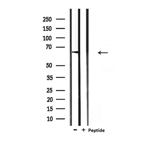 GAD1 / GAD67 Antibody - Western blot analysis of extracts of mouse liver tissue using GAD1 antibody.