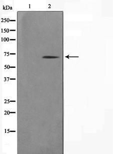 GAD1 / GAD67 Antibody - Western blot analysis on mouse brain cell lysates using GAD1/2 antibody. The lane on the left is treated with the antigen-specific peptide.