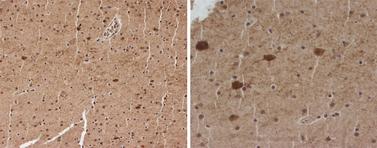 GAD1 / GAD67 Antibody - Anti-Mouse Gad67 staining (10 µg/ml) of a mouse brain formalin-fixed, paraffin-embedded tissue section; seen at 20x (left) and 40x (right) magnification. Staining of neural cells of the brain cortex is observed.